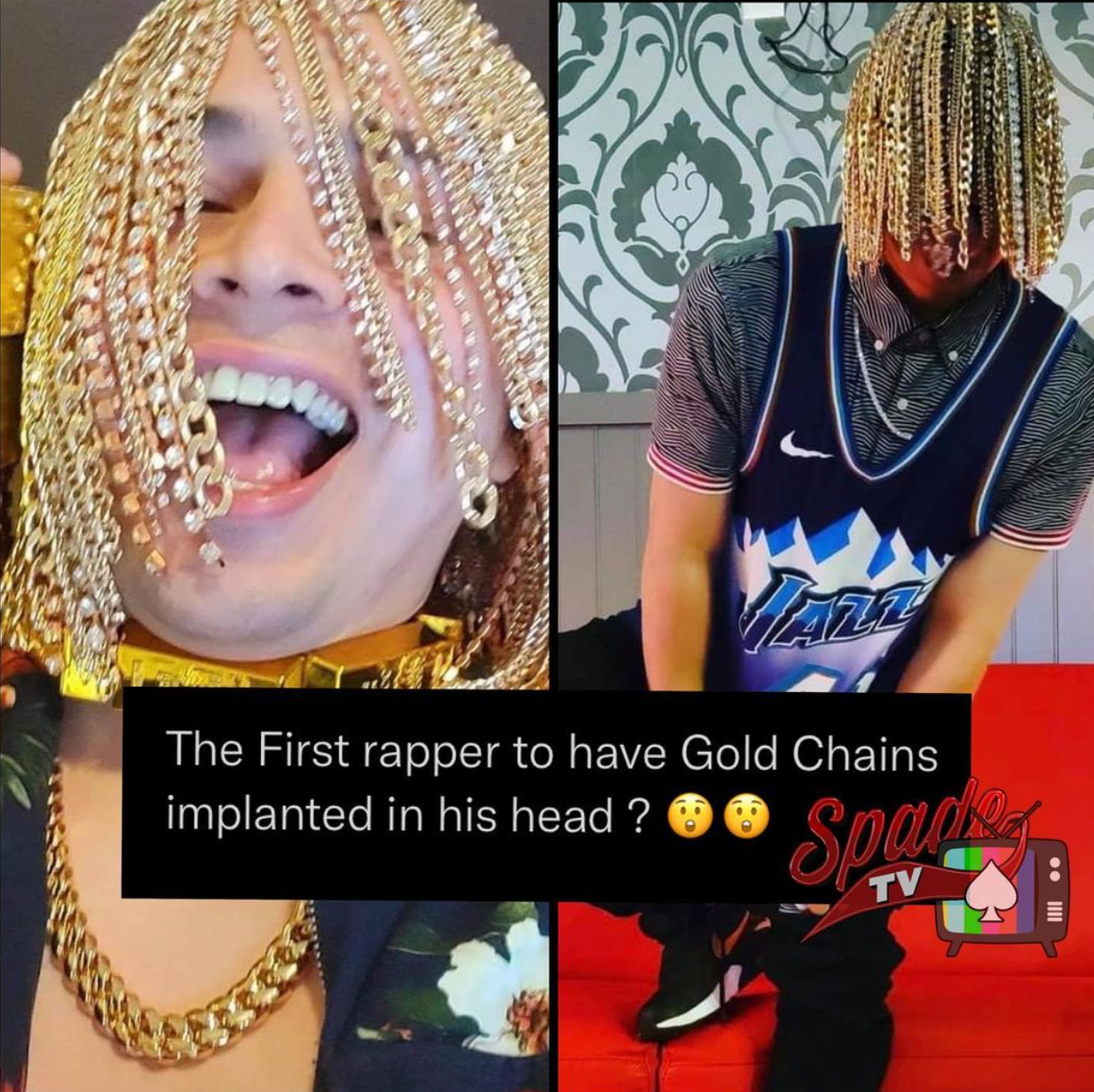 Rapper Dan Sur gets gold chains surgically implanted into his scalp  REVOLT